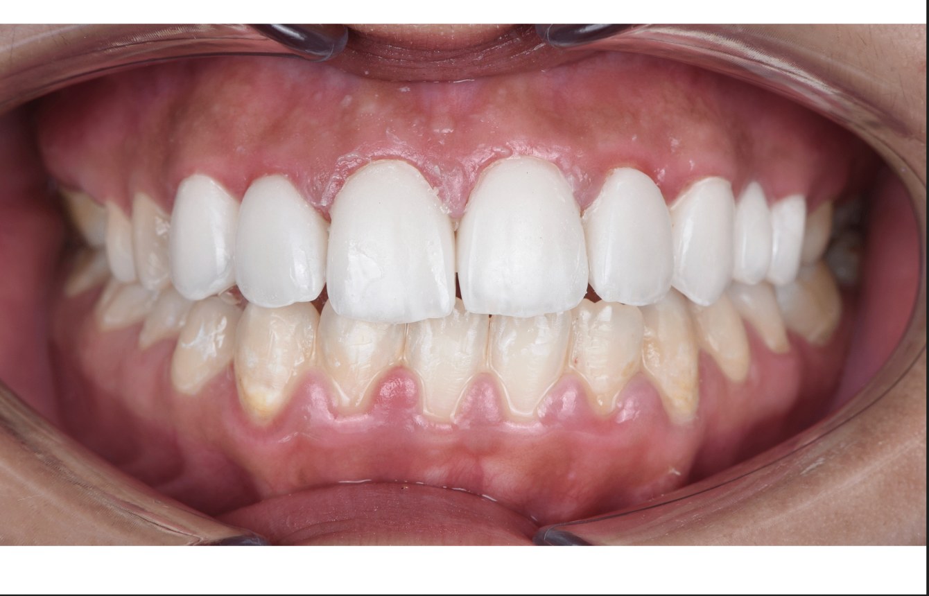 Après — cas 1 Dr. Jihan Agdam