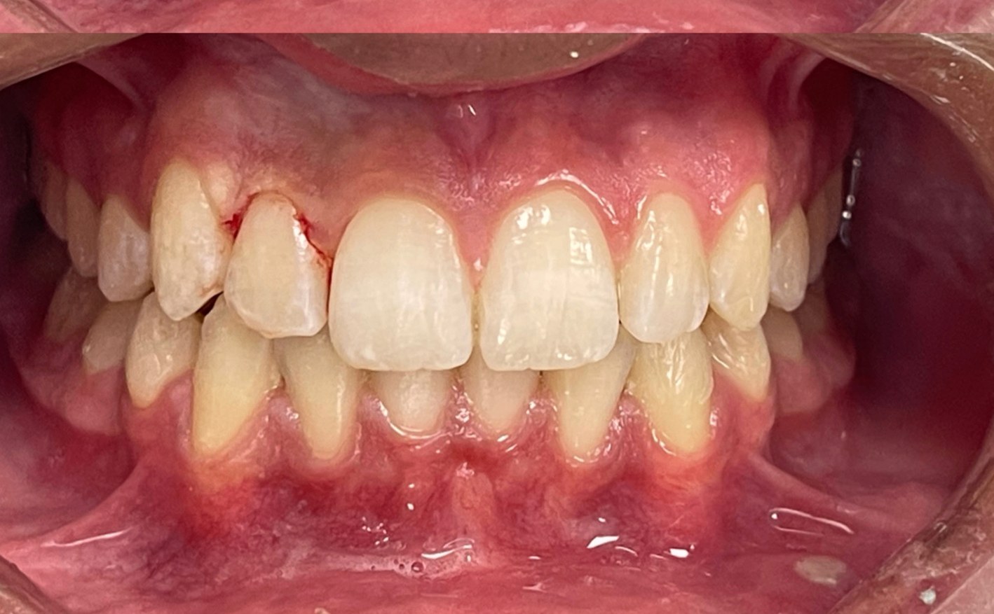 Après — cas 2 Dr. Jihan Agdam