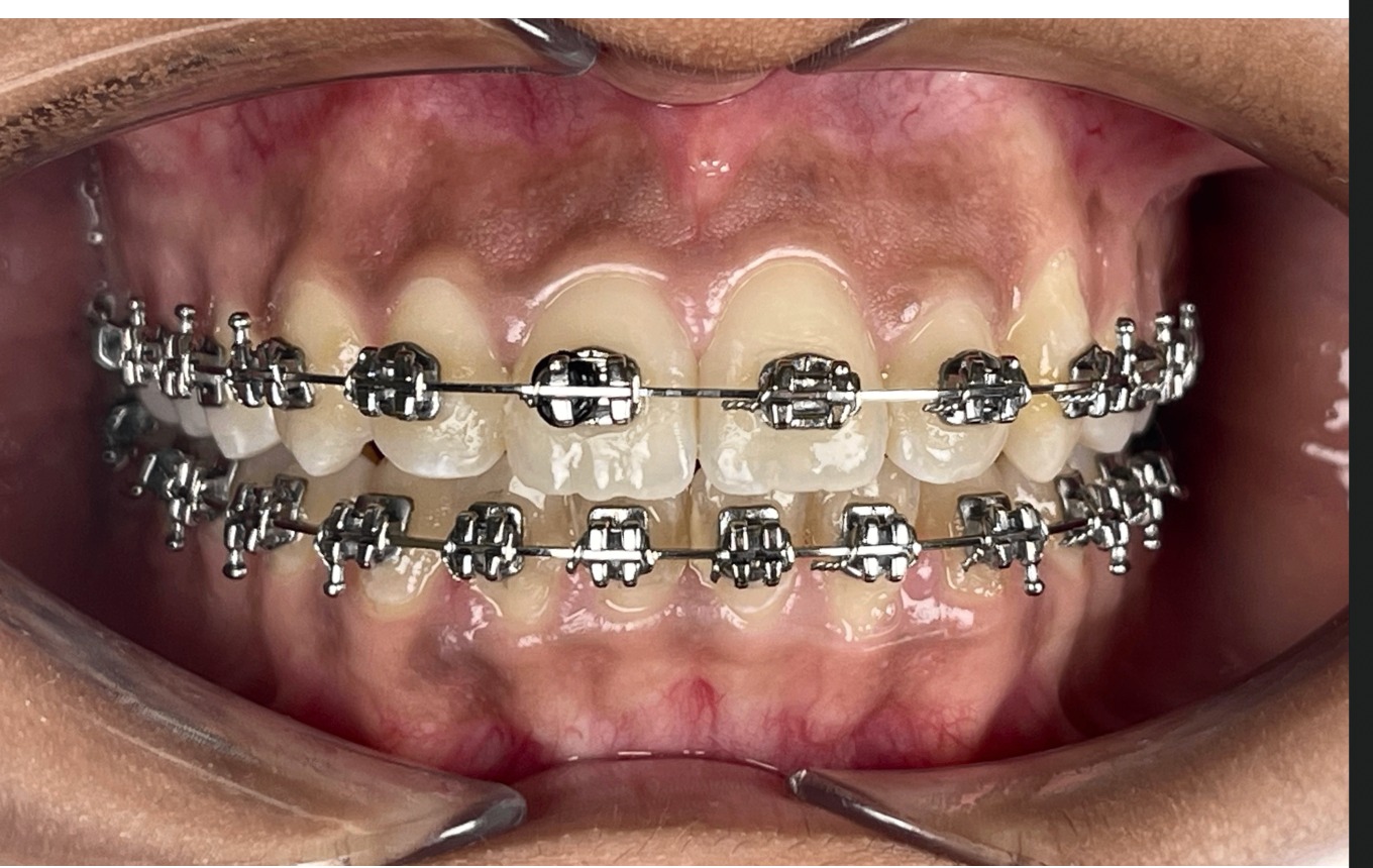 Après — cas 3 Dr. Jihan Agdam