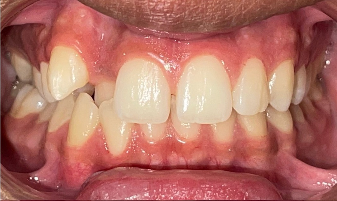 Avant — cas 2 Dr. Jihan Agdam