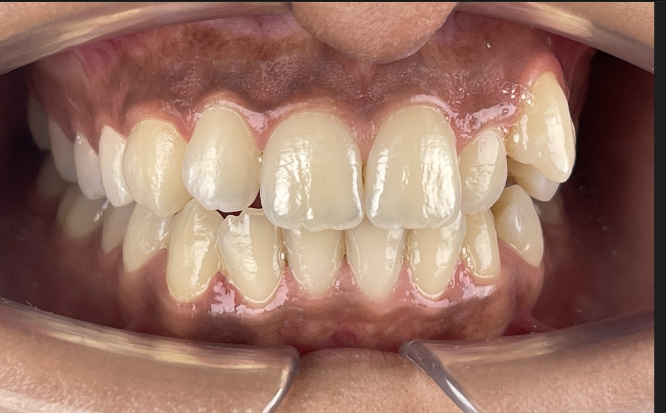 Avant — cas 3 Dr. Jihan Agdam